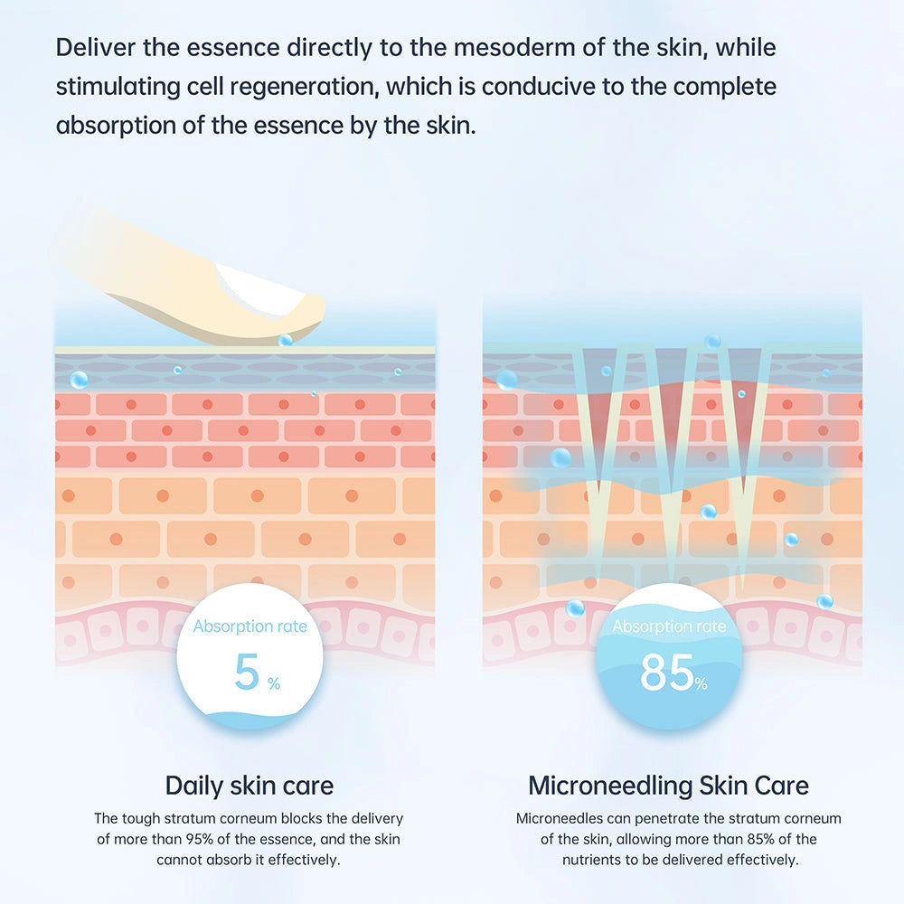Diagram comparing 5% essence absorption with daily skincare to 85% with microneedling.