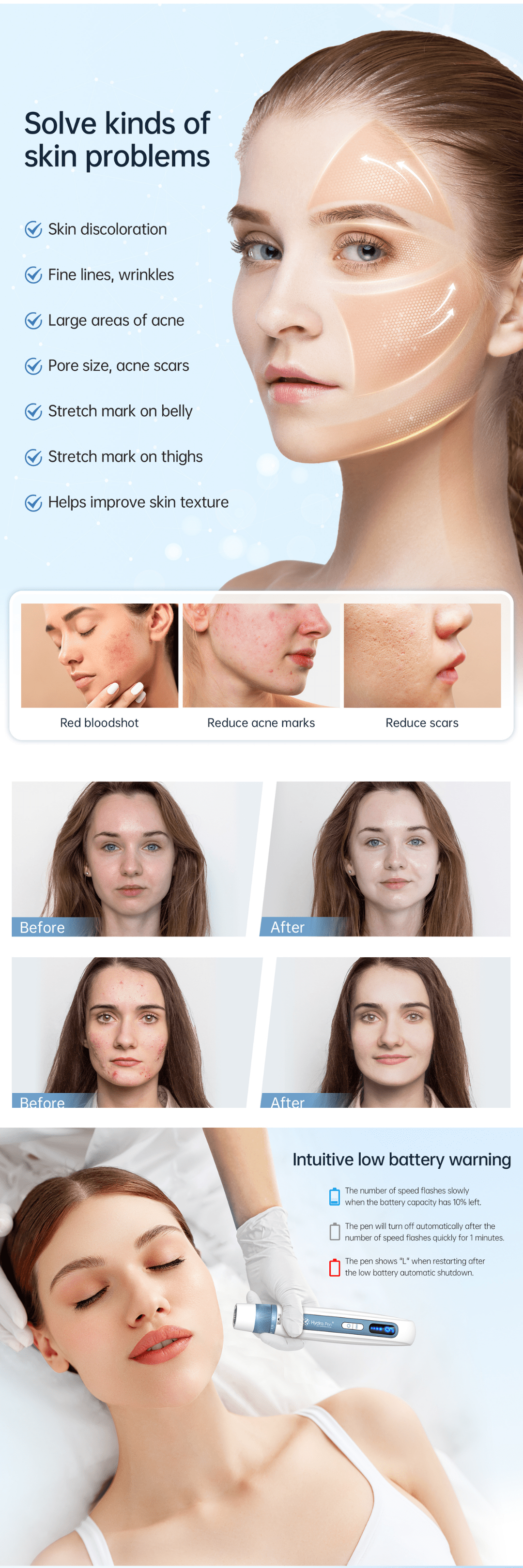 Micro-Needling Device White