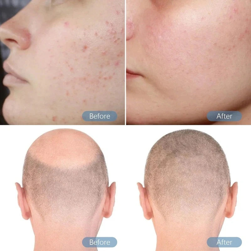 Before and after comparison of skin and hair condition on a person's face and head.