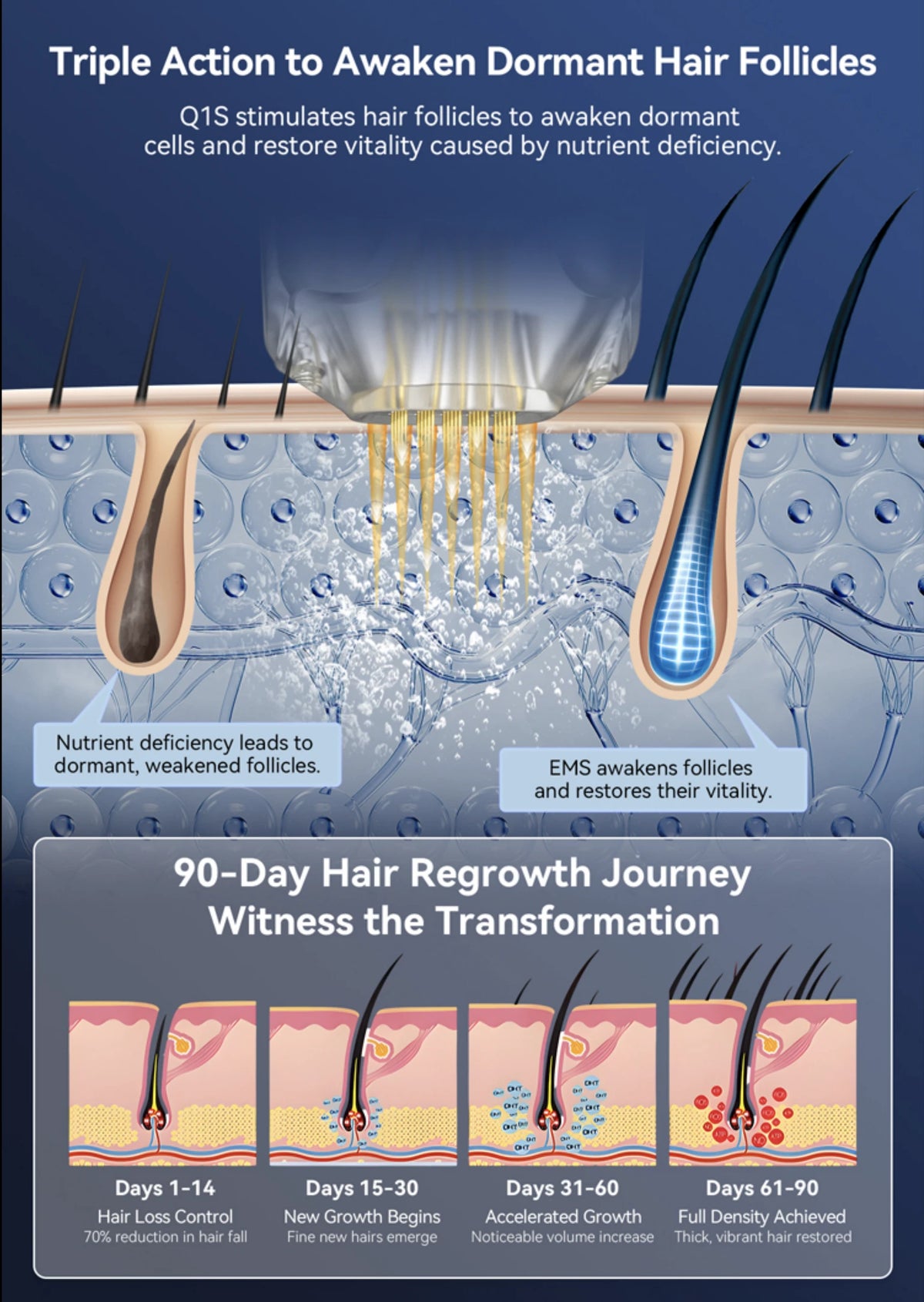 An infographic titled 'Triple Action to Awaken Dormant Hair Follicles' showing a cross-section of human skin with hair follicles, water droplets, and explanatory text about Q1S and EMS treatment. The lower section includes a 90-Day Hair Regrowth Journey timeline with four stage panels from Days 1-14 to Days 61-90.